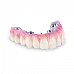 Zirconia-Hybrid-Bridge